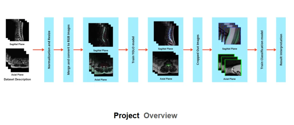 ROI-Guided Lumbar Spine Degeneration Detection
