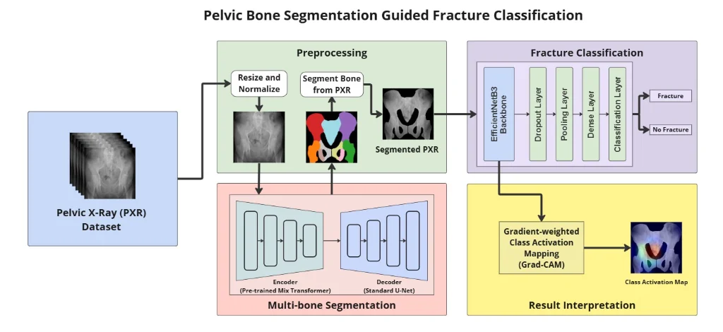 Pelvic Bone Segmentation Guided Fracture Classification