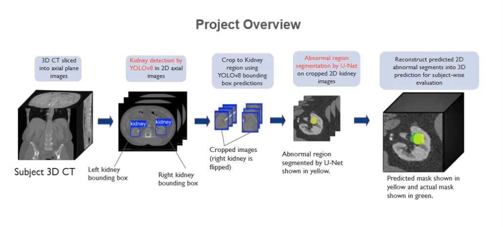 Detection-Guided Kidney Abnormality Segmentation