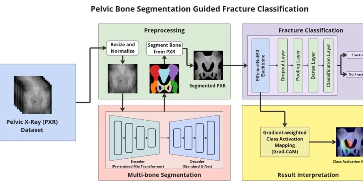 Pelvic Bone Segmentation Guided Fracture Classification | CCDS